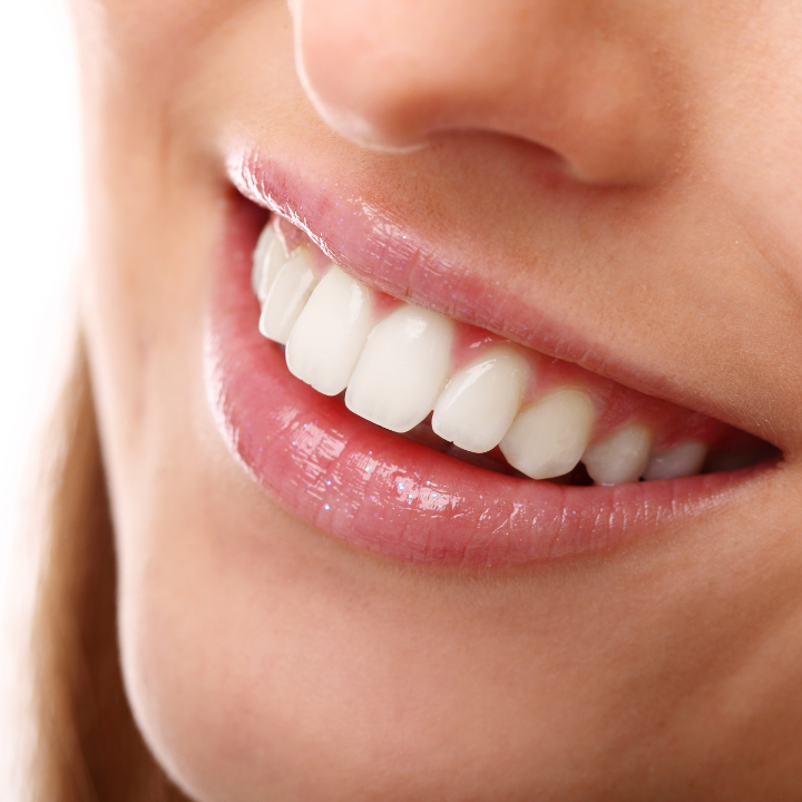 Teeth Whitening Dental Clinics Hong Kong